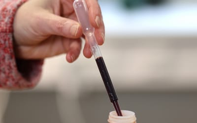Pipette
